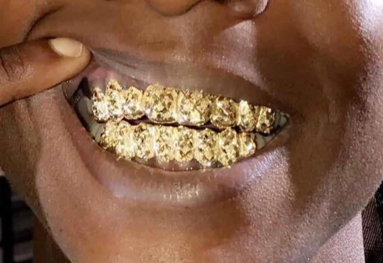 Custom Diamond Dust Diamond Cuts Gold Grillz